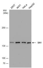 STAG1 Antibody in Western Blot (WB)