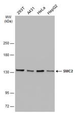 SMC2 Monoclonal Antibody (GT4312)