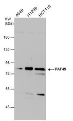 PAF49 Antibody in Western Blot (WB)