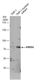 ARID5A Antibody in Western Blot (WB)