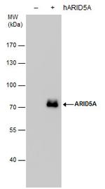 ARID5A Antibody in Western Blot (WB)