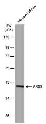 Arginase 2 Antibody in Western Blot (WB)
