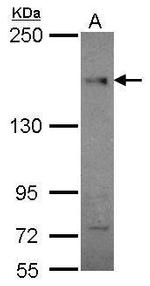 CEP164 Antibody in Western Blot (WB)