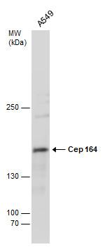 CEP164 Monoclonal Antibody (13)