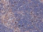 ARHGEF18 Monoclonal Antibody (GT1972)