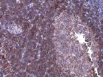 ARHGEF18 Antibody in Immunohistochemistry (Paraffin) (IHC (P))