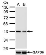 TDP-43 Antibody in Western Blot (WB)