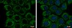 ETHE1 Monoclonal Antibody (GT1621)