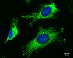FIS1 Antibody in Immunocytochemistry (ICC/IF)