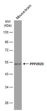 PPP2R2D Monoclonal Antibody (GT577)