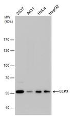 ELP3 Antibody in Western Blot (WB)