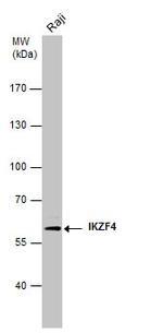 IKZF4 Monoclonal Antibody (GT976)
