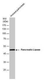 PNLIP Antibody in Western Blot (WB)