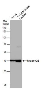 RNaseH2B Monoclonal Antibody (GT673)