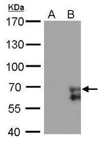 ZNF703 Monoclonal Antibody (GT372)