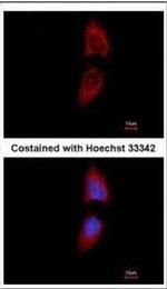 PNPase Monoclonal Antibody (3H5)