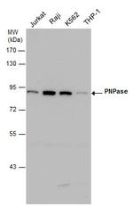 PNPase Monoclonal Antibody (4C11)