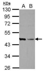 HICE1 Antibody in Western Blot (WB)