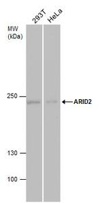 ARID2 Antibody in Western Blot (WB)