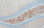 C9orf72 Antibody in Immunohistochemistry (Paraffin) (IHC (P))