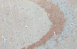 C9orf72 Antibody in Immunohistochemistry (Paraffin) (IHC (P))