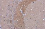 C9orf72 Antibody in Immunohistochemistry (Paraffin) (IHC (P))