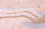C9orf72 Antibody in Immunohistochemistry (Paraffin) (IHC (P))