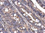 C9orf72 Antibody in Immunohistochemistry (Paraffin) (IHC (P))