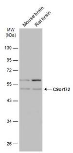 C9orf72 Antibody in Western Blot (WB)