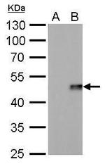 IL-28B Monoclonal Antibody (GT617)