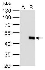 IL-28B Monoclonal Antibody (GT727)