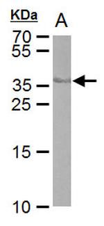Cre recombinase Antibody in Western Blot (WB)