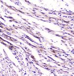 FABP3 Monoclonal Antibody (6C4)