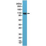 Alpha Actinin 4 Antibody in Western Blot (WB)