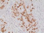 SFTPA1 Recombinant Rabbit Monoclonal Antibody (RM334)