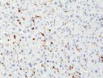 CD45 Antibody in Immunohistochemistry (Paraffin) (IHC (P))
