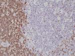 CD5 Recombinant Rabbit Monoclonal Antibody (RM314)