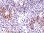 CD49d (Integrin alpha 4) Recombinant Rabbit Monoclonal Antibody (RM268)