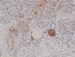 Melan-A Recombinant Rabbit Monoclonal Antibody (RM333)