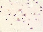 Phospho-GluR1 (Ser845) Recombinant Rabbit Monoclonal Antibody (RM296)