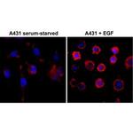 Phosphotyrosine Recombinant Rabbit Monoclonal Antibody (RM111)