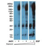 Phosphotyrosine Antibody in Western Blot (WB)
