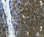CD4 Antibody in Immunohistochemistry (Frozen) (IHC (F))