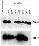 Phospho-CD247 (CD3 zeta) (Tyr153) Antibody in Western Blot (WB)