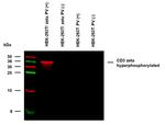 Phospho-CD247 (CD3 zeta) (Tyr153) Antibody in Western Blot (WB)