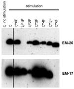 Phospho-CD247 (CD3 zeta) (Tyr72) Antibody in Western Blot (WB)