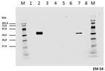 Phospho-CD247 (CD3 zeta) (Tyr142) Antibody in Western Blot (WB)