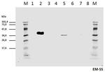 Phospho-CD247 (CD3 zeta) (Tyr111, Tyr123) Antibody in Western Blot (WB)