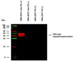 Phospho-CD247 (CD3 zeta) (Tyr111, Tyr123) Antibody in Western Blot (WB)
