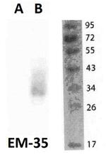 FOLR2 Monoclonal Antibody (EM-35)